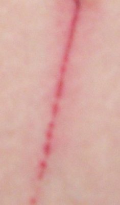 Demonic Attack 1/12/11 "I felt one scratch (2 1/2 inches long) below my belly button"